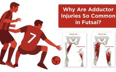 ¿Por qué las lesiones aductoras son tan comunes en el fútbol sala?